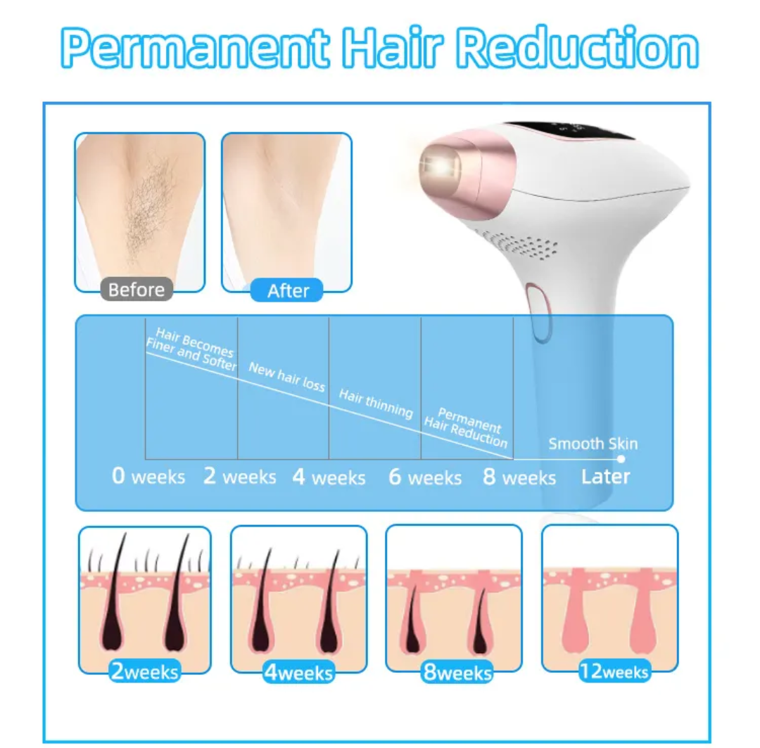 Depilador laser alfa - Image 11
